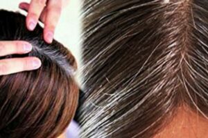 wellhealthorganic.com/know-the-causes-of-white-hair-and-easy-ways-to-prevent-it-naturally