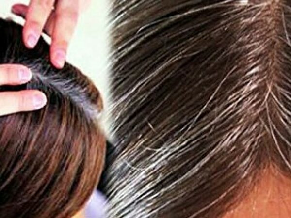wellhealthorganic.com/know-the-causes-of-white-hair-and-easy-ways-to-prevent-it-naturally
