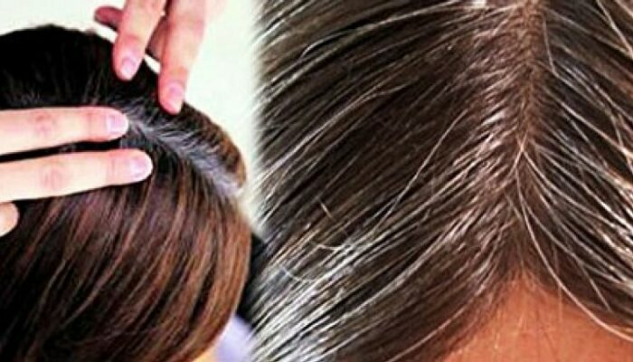 wellhealthorganic.com/know-the-causes-of-white-hair-and-easy-ways-to-prevent-it-naturally