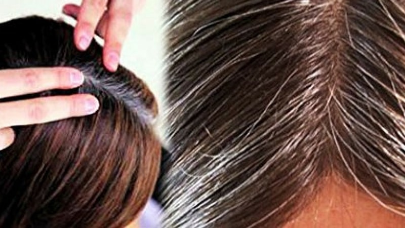 wellhealthorganic.com/know-the-causes-of-white-hair-and-easy-ways-to-prevent-it-naturally